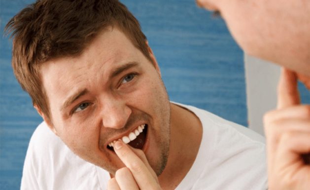 Viêm nha chu làm răng lung lay là gì?