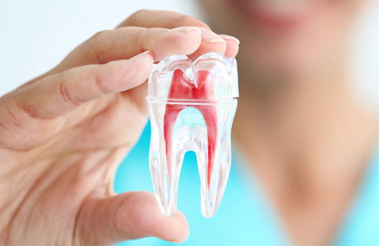 Nguyên tắc điều trị và quy trình lấy tủy răng  Vinmec