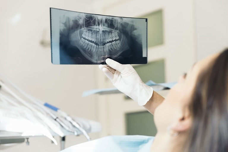 Cách điều trị viêm tủy răng
