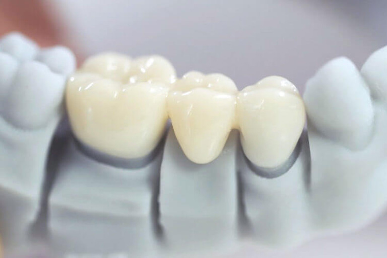 Trường hợp đau khi bọc răng sứ do đâu?
