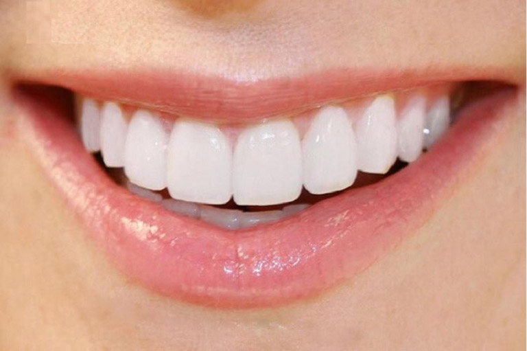 Tìm hiểu vai trò của răng cửa