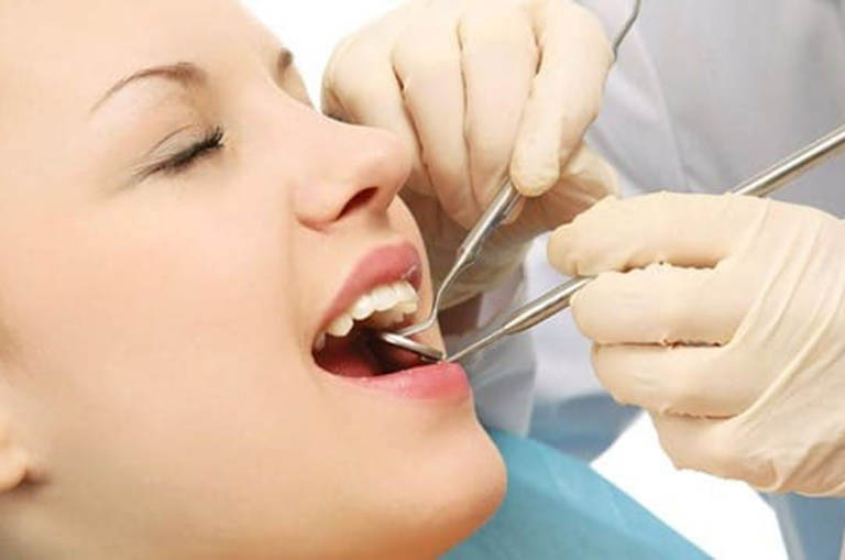 Cách giảm xử lý răng bị ê buốt sau khi bọc sứ