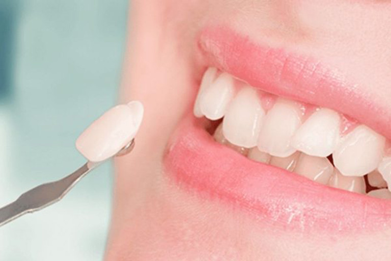 Cách giảm xử lý răng bị ê buốt sau khi bọc sứ