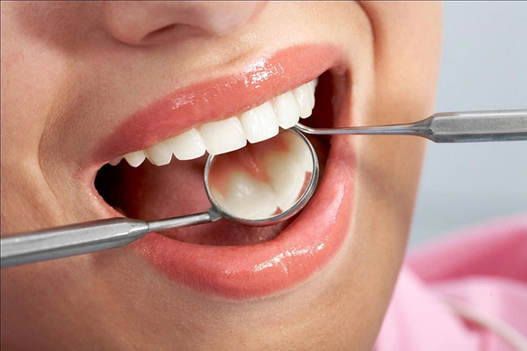 Phương pháp giúp bảo tồn răng lấy tủy tốt nhất