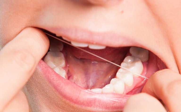 Răng khôn bị viêm tủy có nguy hiểm?