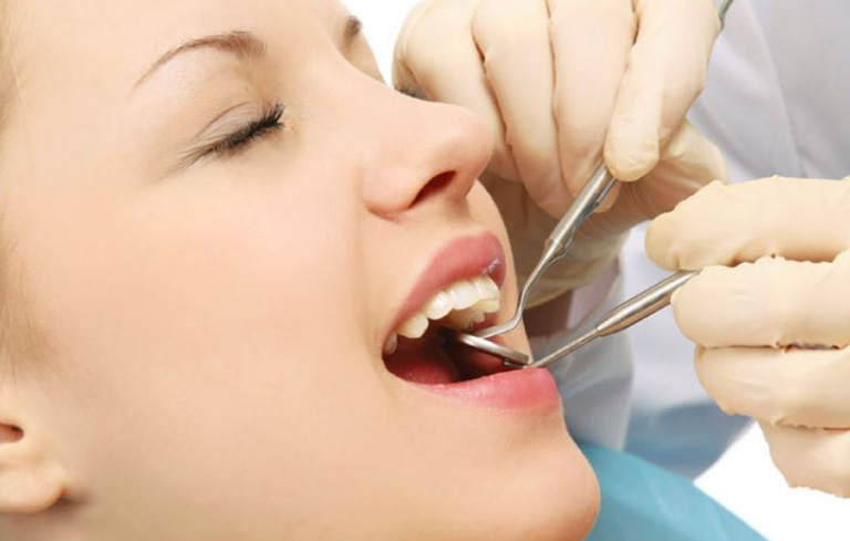 Phương pháp điều trị viêm tủy răng cửa