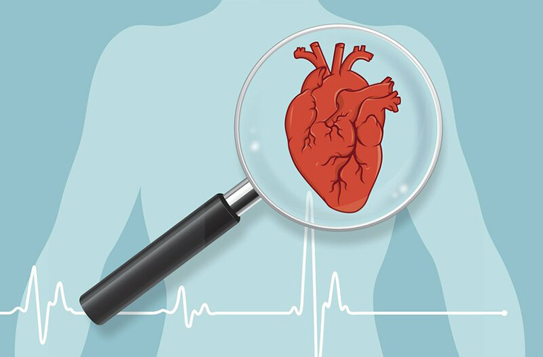 Bệnh tim thiếu máu cục bộ là gì?
