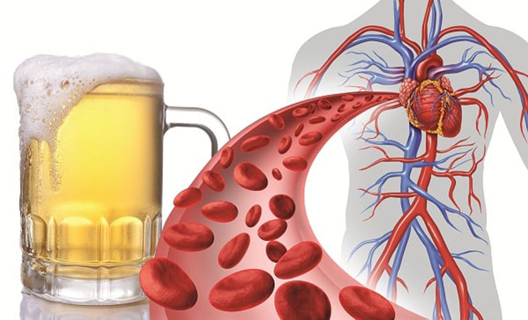 Uống rượu bia có làm tăng huyết áp không?