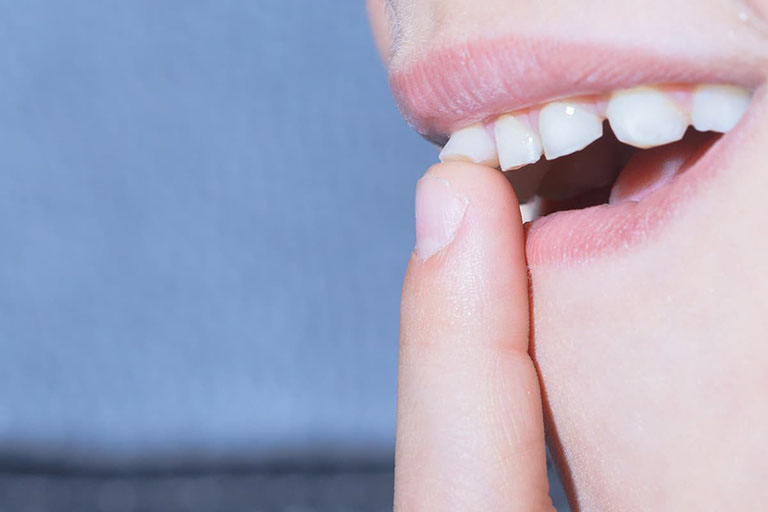 Răng sâu có tự rụng không?
