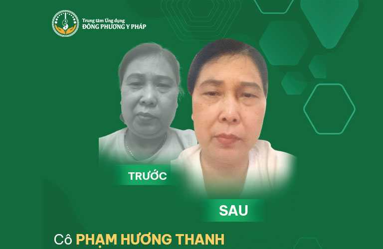 Bn.Phạm Hương Thanh chia sẻ sau khi điều trị