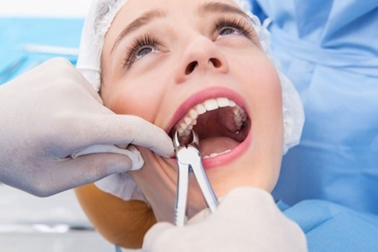 Phương pháp kiểm soát sâu răng mặt nhai 