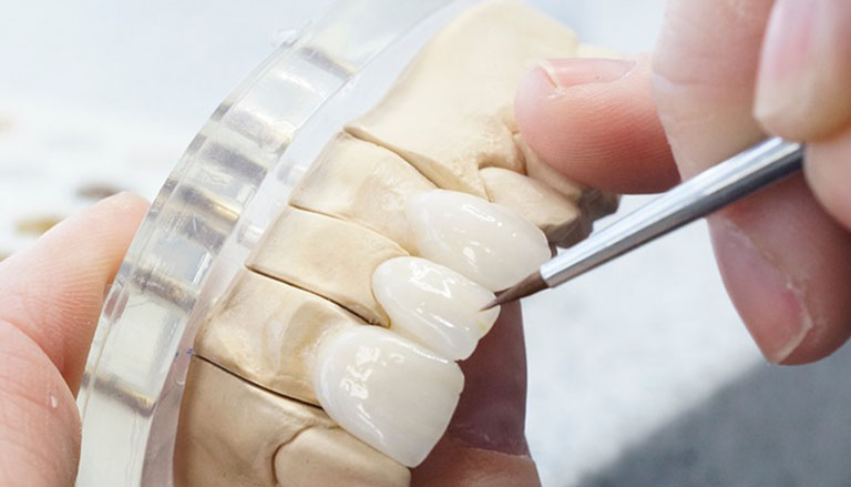 Răng bọc sứ bị viêm tủy là do đâu?