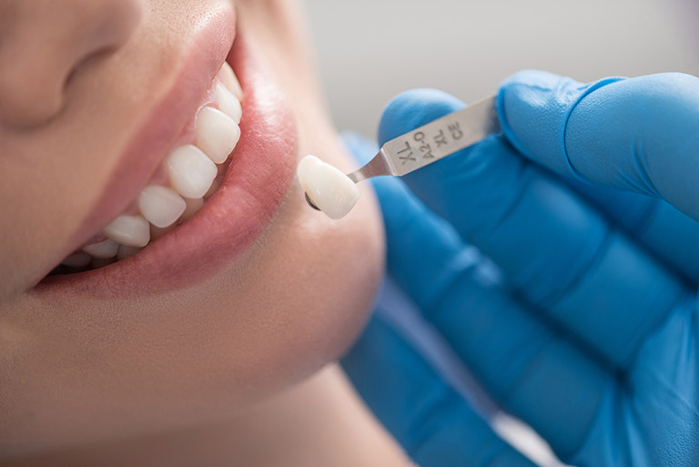 Các giải pháp xử lý răng bọc sứ bị viêm tủy