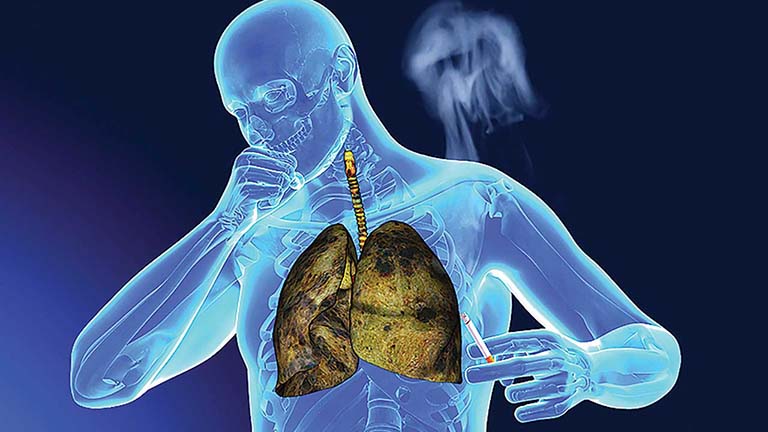 nguyên nhân ung thư phổi