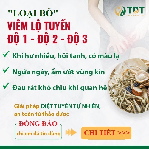 Banner viêm lộ tuyến