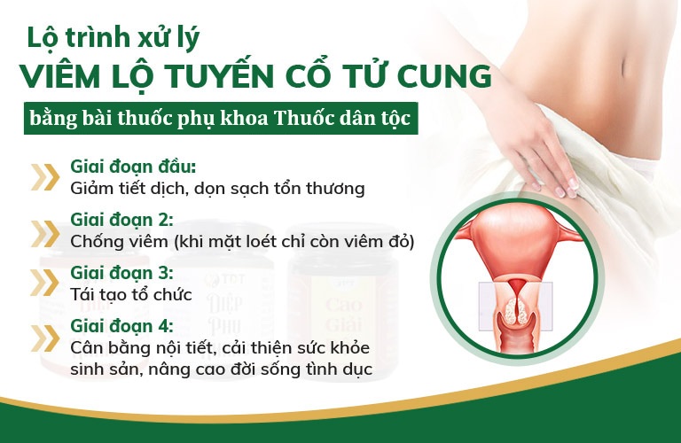 Lộ trình xử lý viêm lộ tuyến bằng bài thuốc phụ khoa Thuốc dân tộc