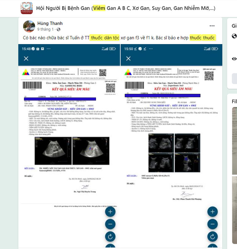 Phản hồi của người bệnh về bài thuốc Bảo nam Ích can thang trên mạng xã hội