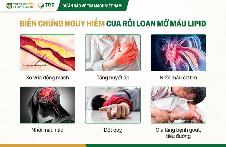 Một số nhóm đối tượng cần chú ý tầm soát mỡ máu thường xuyên