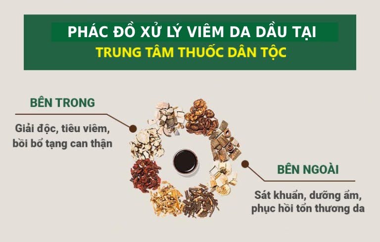 Viêm da dầu xử lý đúng cách theo phác đồ