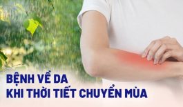 Bệnh viêm da ngày giao mùa