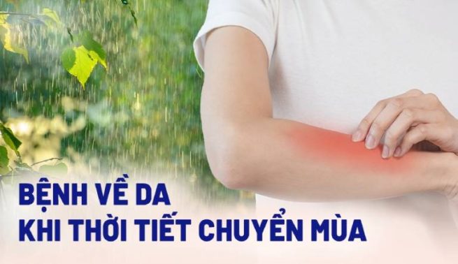 Bệnh viêm da ngày giao mùa