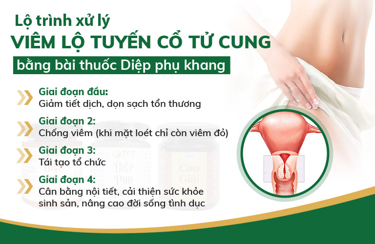 Các giai đoạn loại bỏ viêm lộ tuyến Cổ tử cung